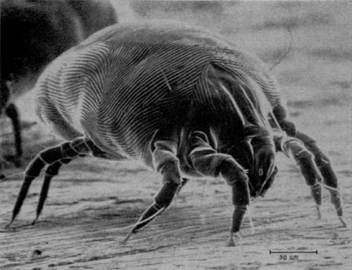 Kill Dust Mites: How to Kick them Out of Your Bed for Good