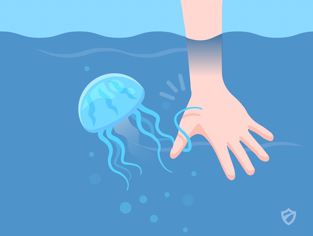 jellyfish stinging someone